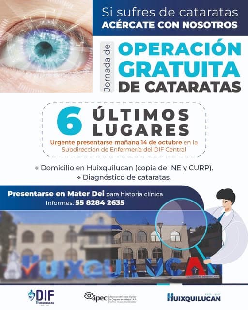 Últimos espacios para cirugía gratuita de cataratas